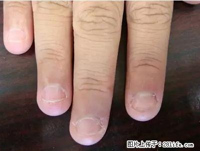 剪指甲、挖耳屎，这些日常小动作竟隐藏大危害！ - 枣庄生活资讯 - 枣庄28生活网 zaozhuang.28life.net
